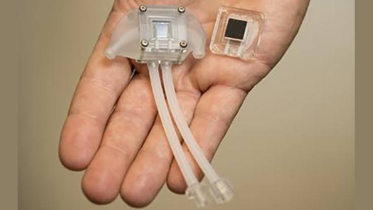 This Artificial Kidney Eliminates The Need For Kidney Dialysis